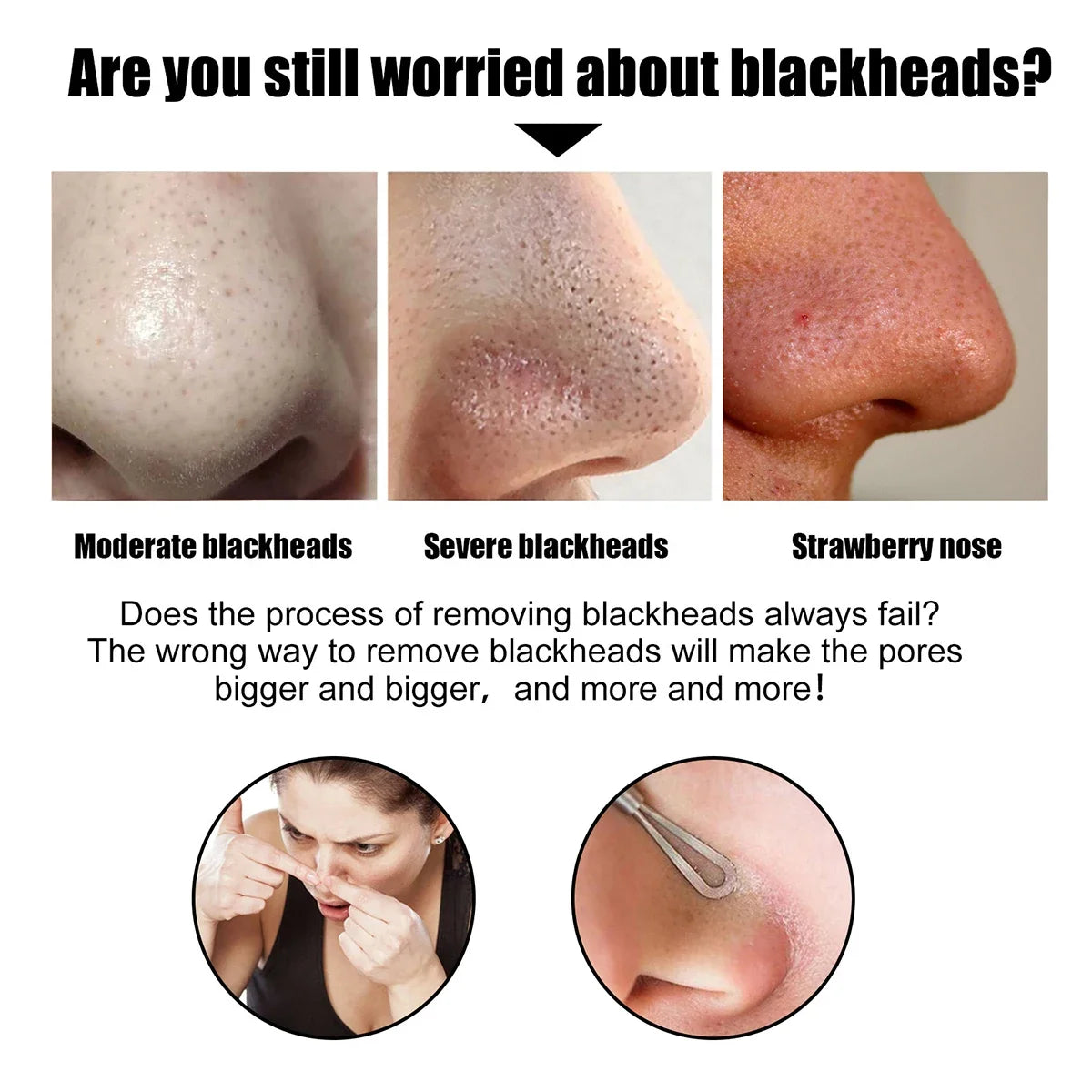 Blackhead Remover Nose Patches