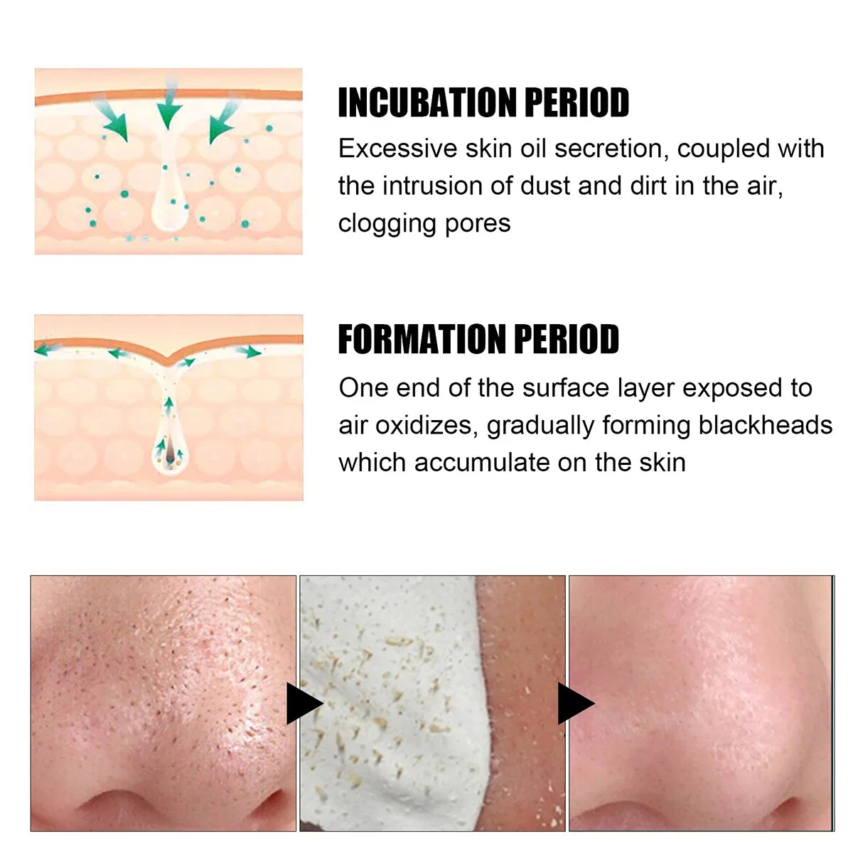 Blackhead Remover Nose Patches